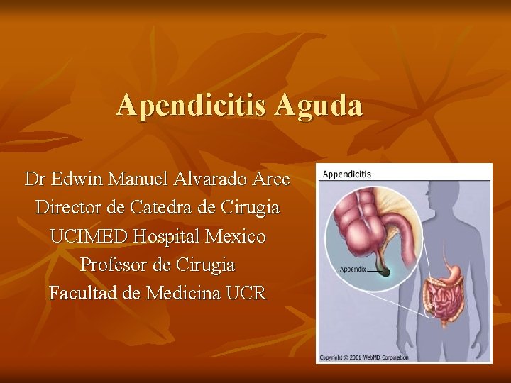 Apendicitis Aguda Dr Edwin Manuel Alvarado Arce Director de Catedra de Cirugia UCIMED Hospital