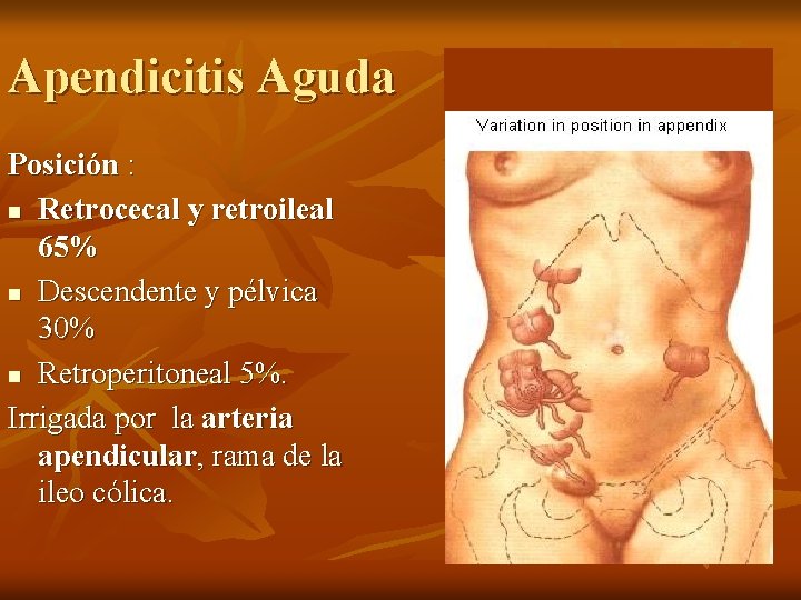 Apendicitis Aguda Posición : n Retrocecal y retroileal 65% n Descendente y pélvica 30%