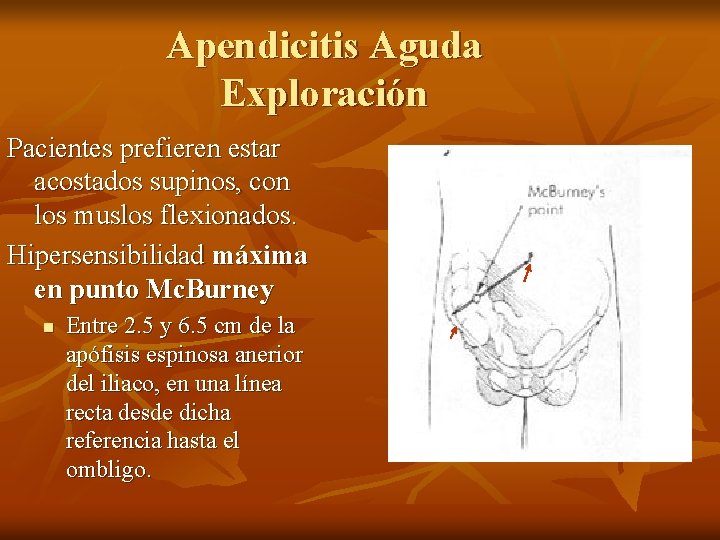 Apendicitis Aguda Exploración Pacientes prefieren estar acostados supinos, con los muslos flexionados. Hipersensibilidad máxima