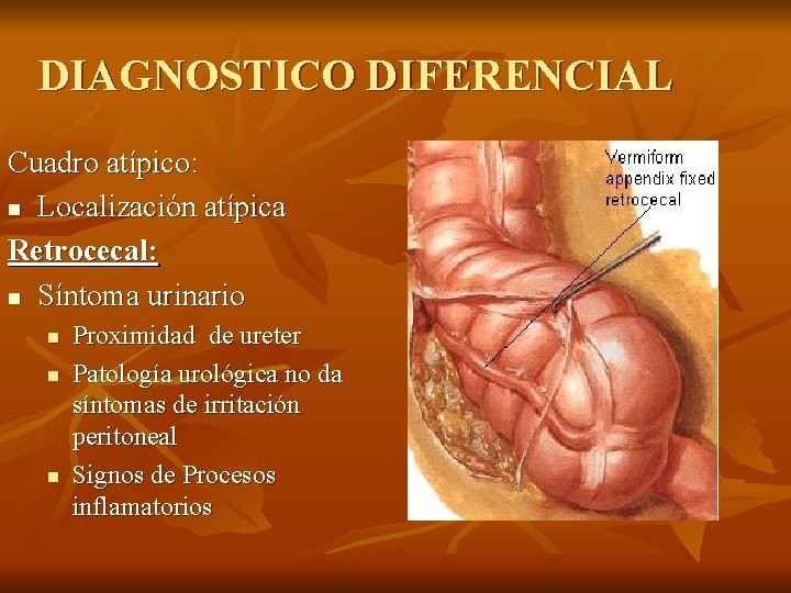 DIAGNOSTICO DIFERENCIAL Cuadro atípico: n Localización atípica Retrocecal: n Síntoma urinario n n n