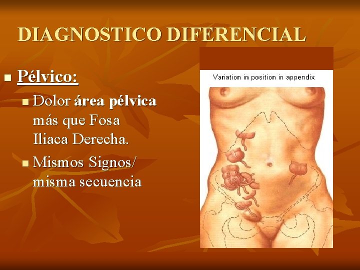 DIAGNOSTICO DIFERENCIAL n Pélvico: Dolor área pélvica más que Fosa Iliaca Derecha. n Mismos