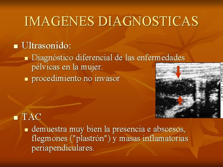 IMAGENES DIAGNOSTICAS n Ultrasonido: n n n Diagnóstico diferencial de las enfermedades pélvicas en