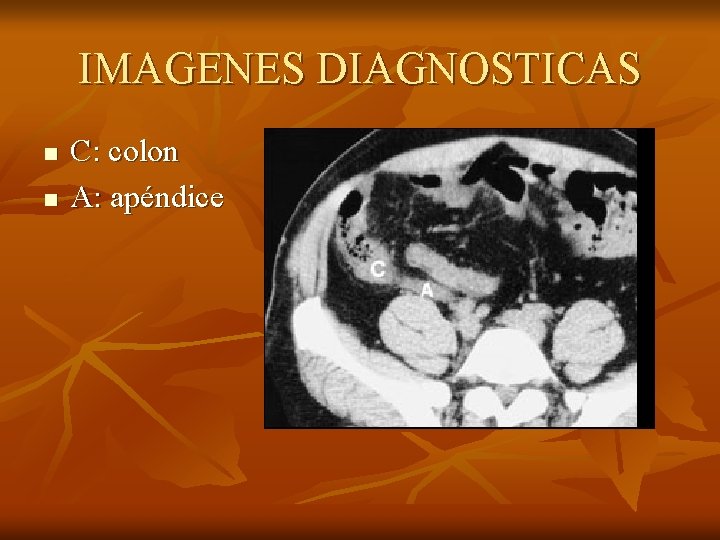 IMAGENES DIAGNOSTICAS n n C: colon A: apéndice 