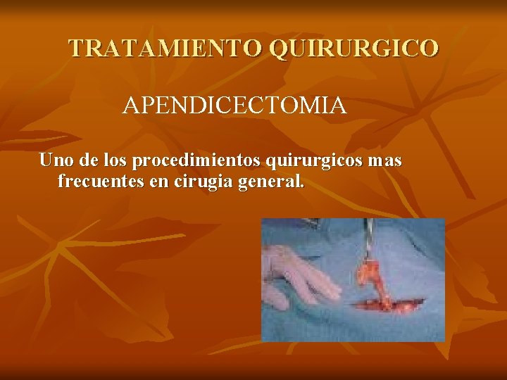 TRATAMIENTO QUIRURGICO APENDICECTOMIA Uno de los procedimientos quirurgicos mas frecuentes en cirugia general. 