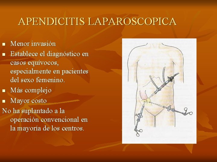 APENDICITIS LAPAROSCOPICA Menor invasión n Establece el diagnóstico en casos equívocos, especialmente en pacientes