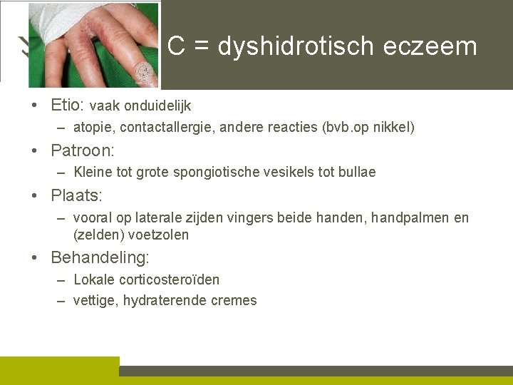 C = dyshidrotisch eczeem • Etio: vaak onduidelijk – atopie, contactallergie, andere reacties (bvb.