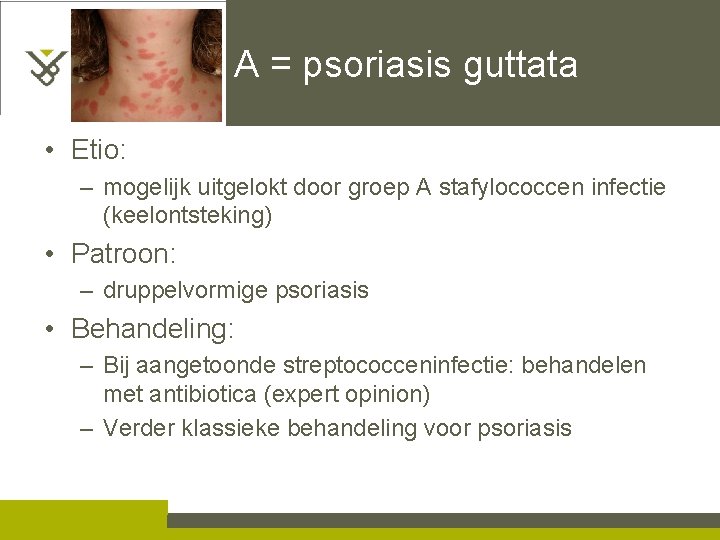 A = psoriasis guttata • Etio: – mogelijk uitgelokt door groep A stafylococcen infectie