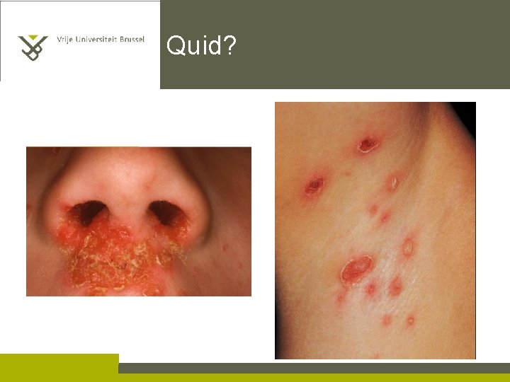 Quid? 