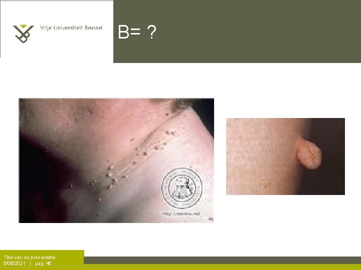 B= ? Titel van de presentatie 5/06/2021 | pag. 45 