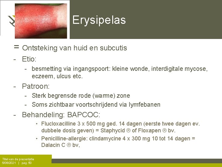 Erysipelas = Ontsteking van huid en subcutis - Etio: - besmetting via ingangspoort: kleine