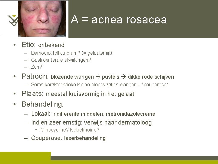 A = acnea rosacea • Etio: onbekend – Demodex folliculorum? (= gelaatsmijt) – Gastroenterale