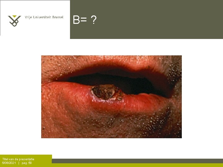 B= ? Titel van de presentatie 5/06/2021 | pag. 58 