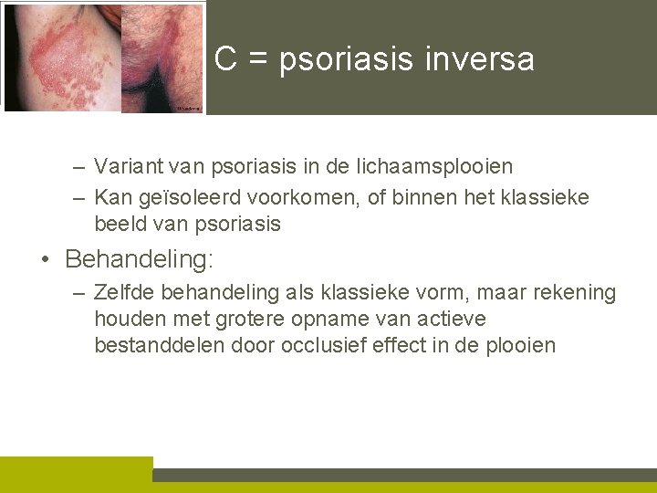 C = psoriasis inversa – Variant van psoriasis in de lichaamsplooien – Kan geïsoleerd