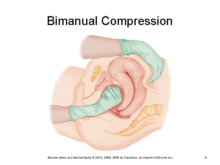 Bimanual Compression Elsevier items and derived items © 2013, 2009, 2005 by Saunders, an