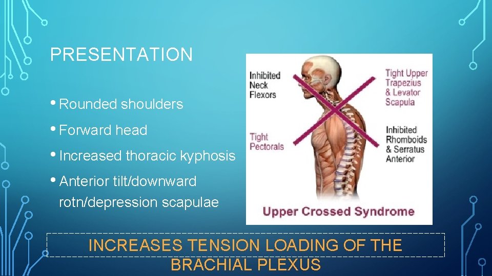 PRESENTATION • Rounded shoulders • Forward head • Increased thoracic kyphosis • Anterior tilt/downward