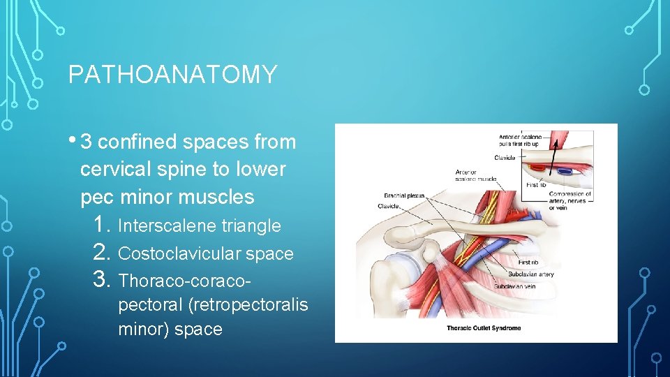 PATHOANATOMY • 3 confined spaces from cervical spine to lower pec minor muscles 1.