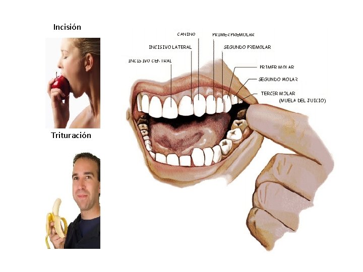 Incisión Trituración 