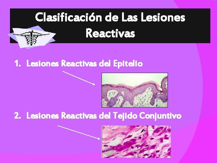 Clasificación de Las Lesiones Reactivas 1. Lesiones Reactivas del Epitelio 2. Lesiones Reactivas del