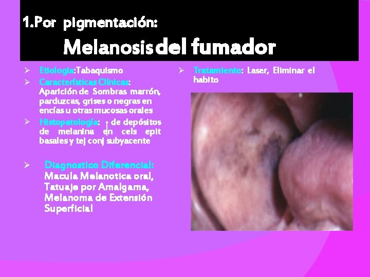 1. Por pigmentación: Melanosis del fumador Etiologia: Tabaquismo Características Clínicas: Aparición de Sombras marrón,