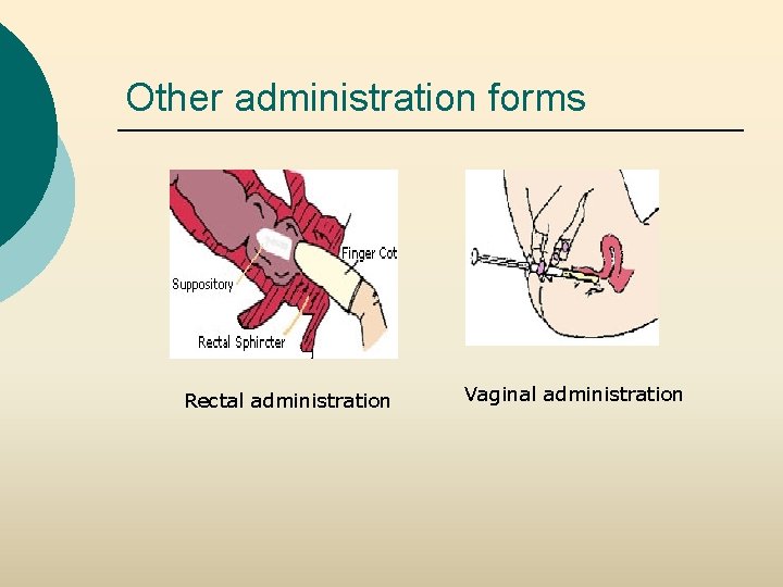 Other administration forms Rectal administration Vaginal administration 