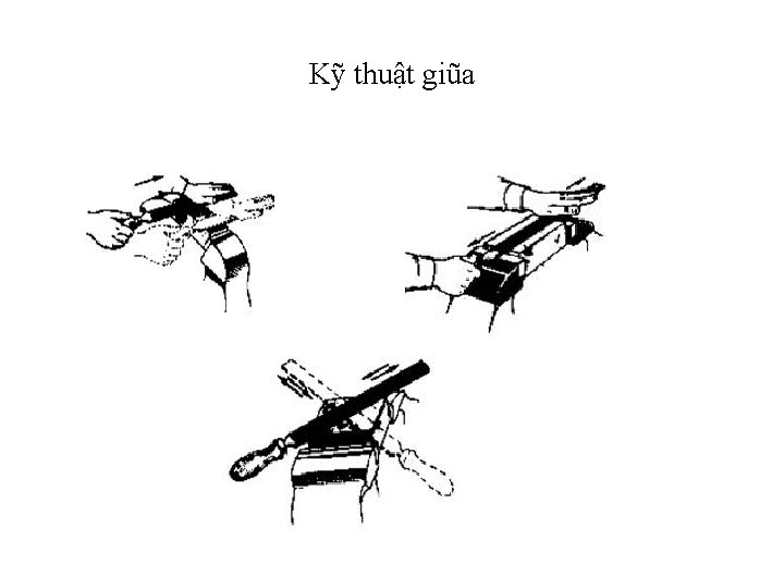 Kỹ thuật giũa 