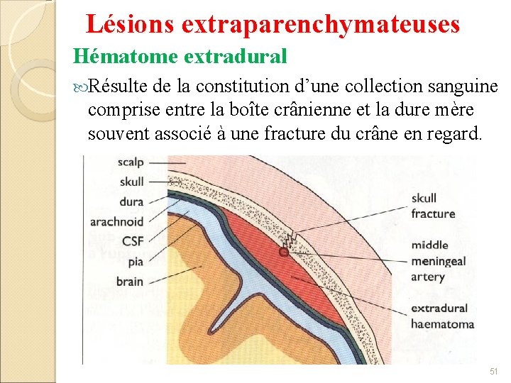 Lésions extraparenchymateuses Hématome extradural Résulte de la constitution d’une collection sanguine comprise entre la