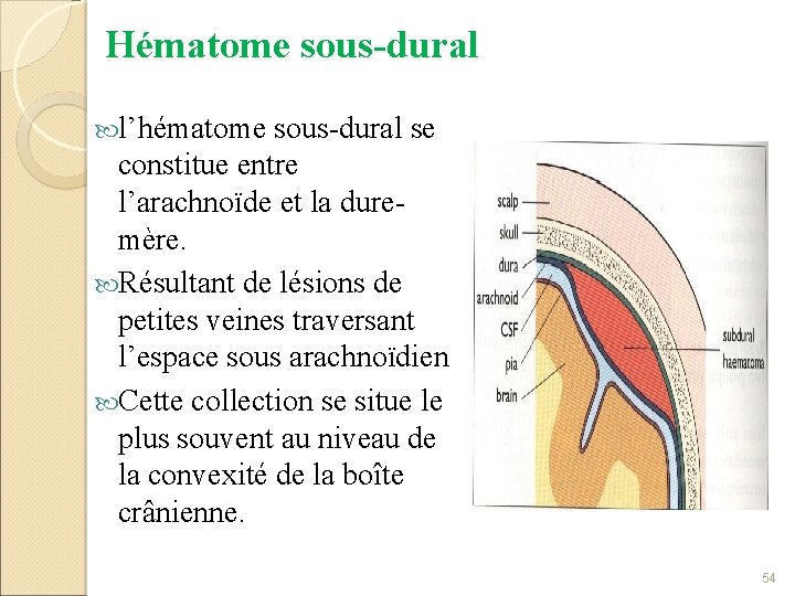 Hématome sous-dural l’hématome sous-dural se constitue entre l’arachnoïde et la duremère. Résultant de lésions