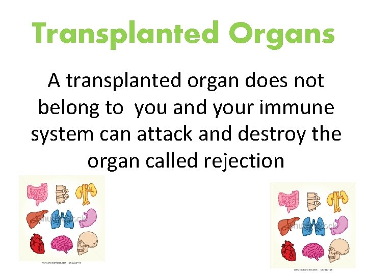 Transplanted Organs A transplanted organ does not belong to you and your immune system