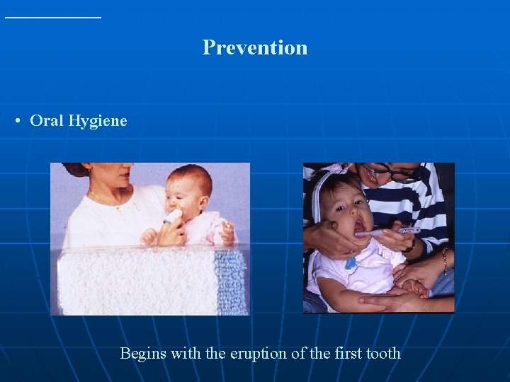 Prevention • Oral Hygiene Begins with the eruption of the first tooth 