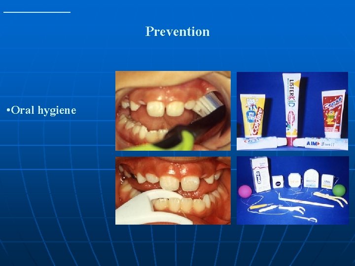Prevention • Oral hygiene 