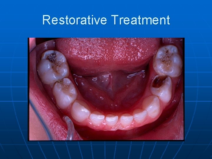Restorative Treatment 