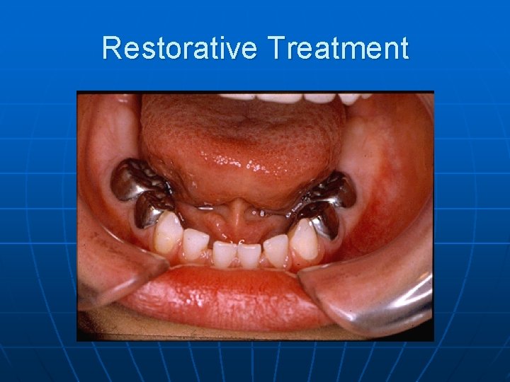 Restorative Treatment 