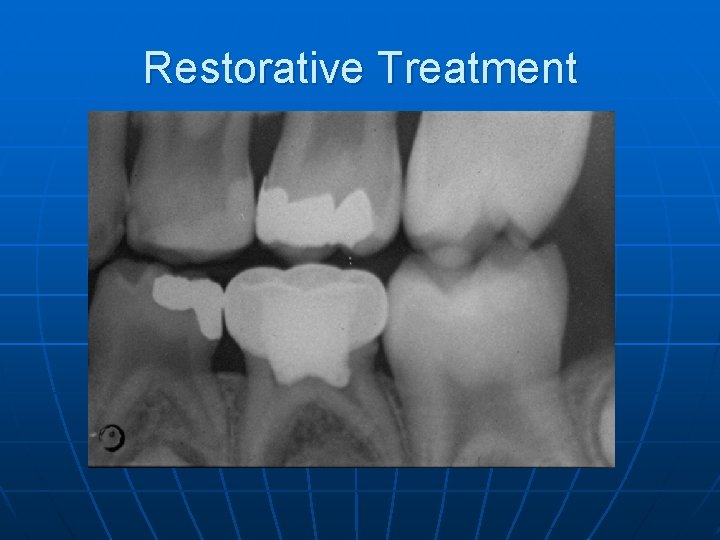 Restorative Treatment 
