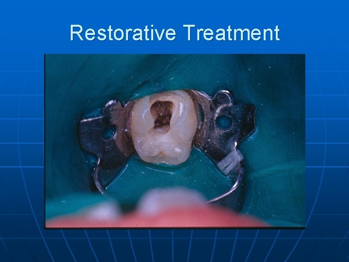 Restorative Treatment 