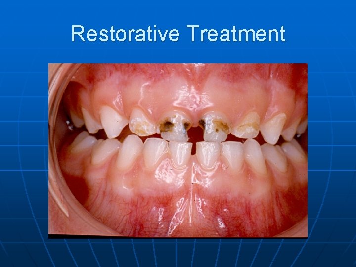 Restorative Treatment 