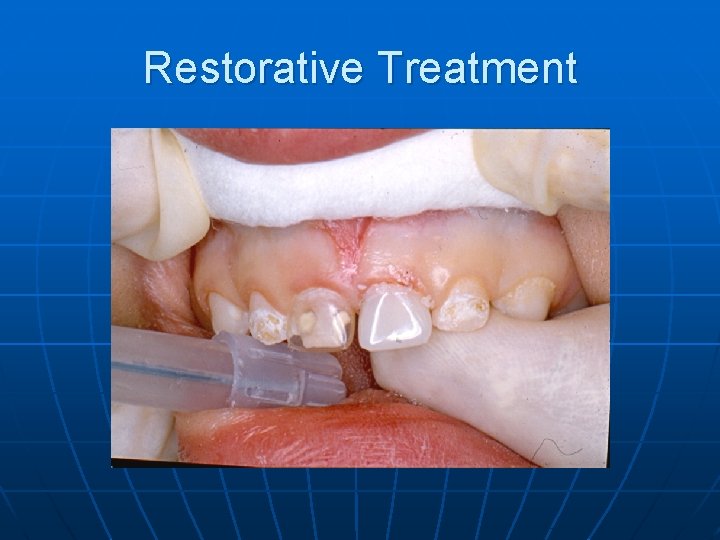 Restorative Treatment 