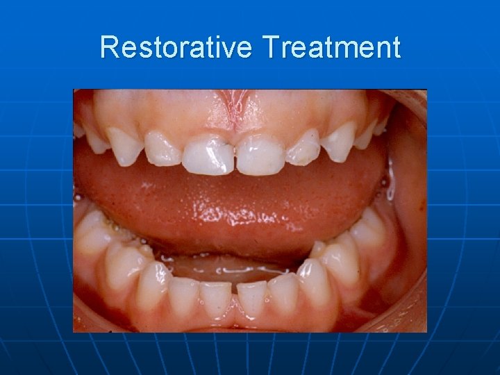 Restorative Treatment 