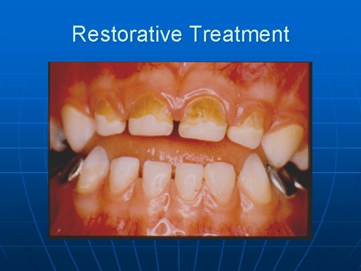 Restorative Treatment 