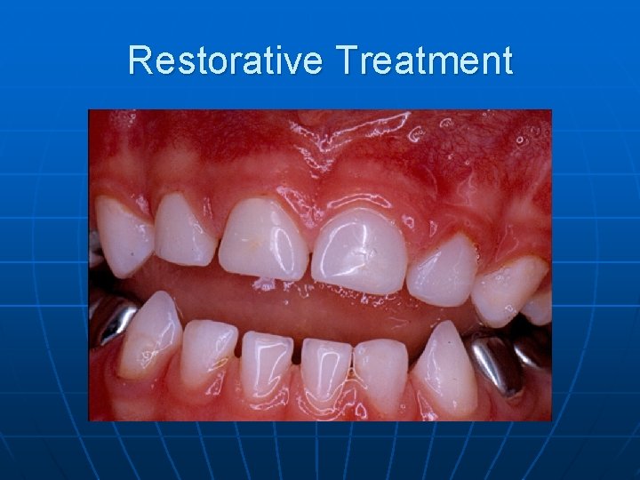 Restorative Treatment 