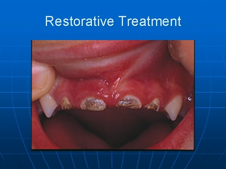 Restorative Treatment 