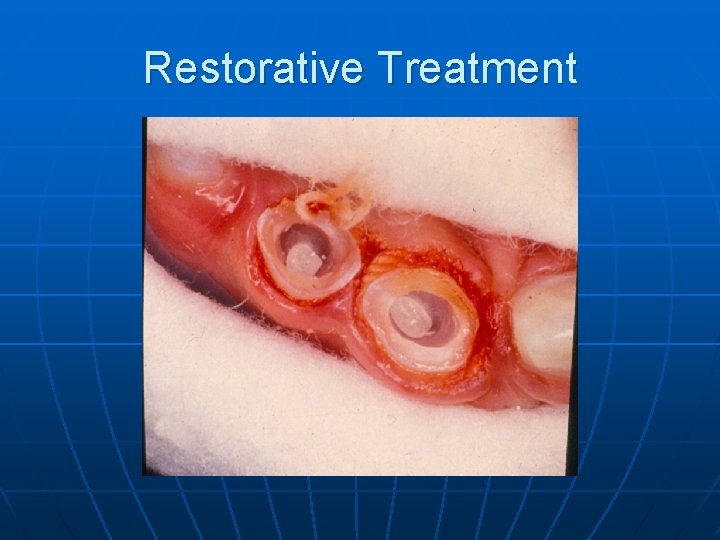 Restorative Treatment 