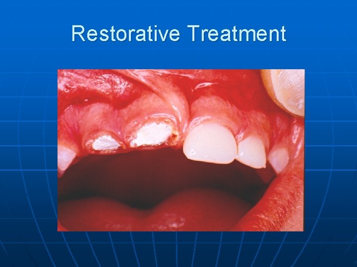 Restorative Treatment 
