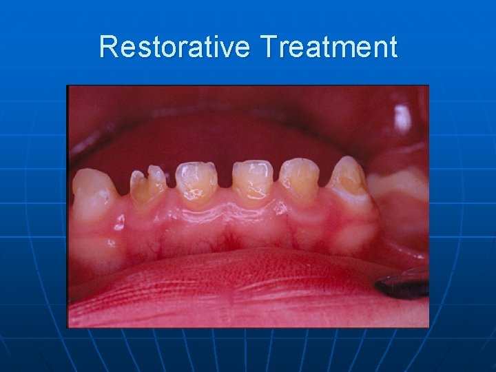 Restorative Treatment 