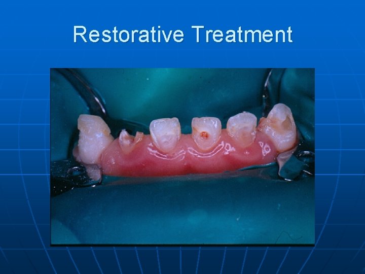 Restorative Treatment 