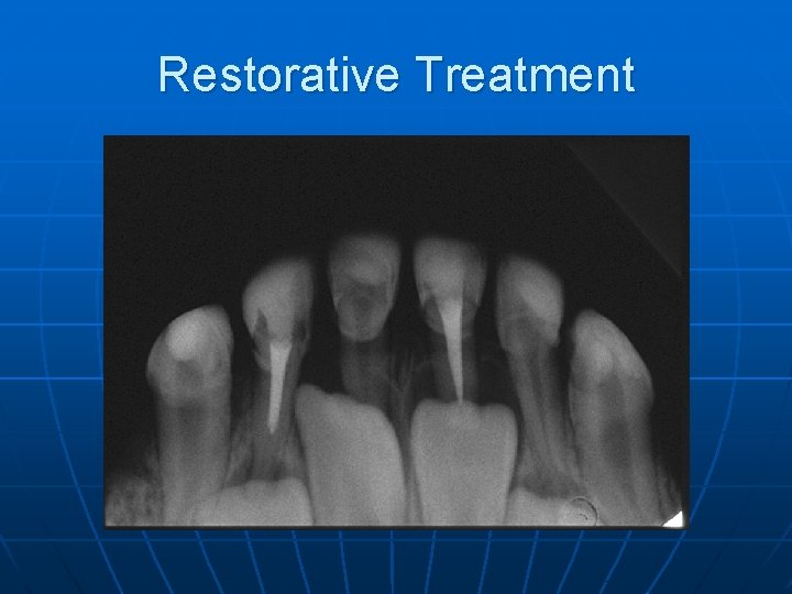 Restorative Treatment 