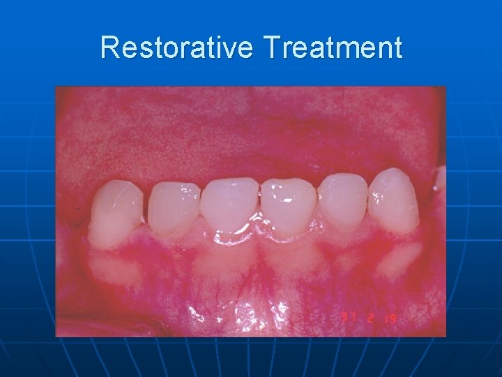 Restorative Treatment 