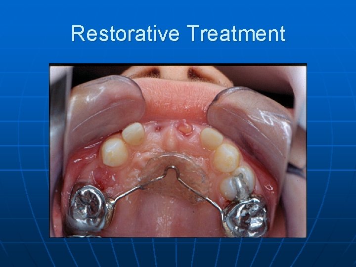 Restorative Treatment 