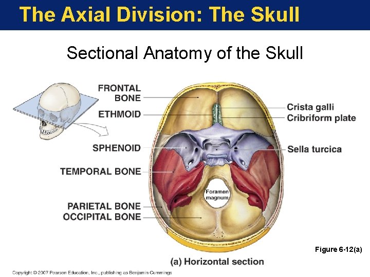 The Axial Division: The Skull Sectional Anatomy of the Skull Figure 6 -12(a) 