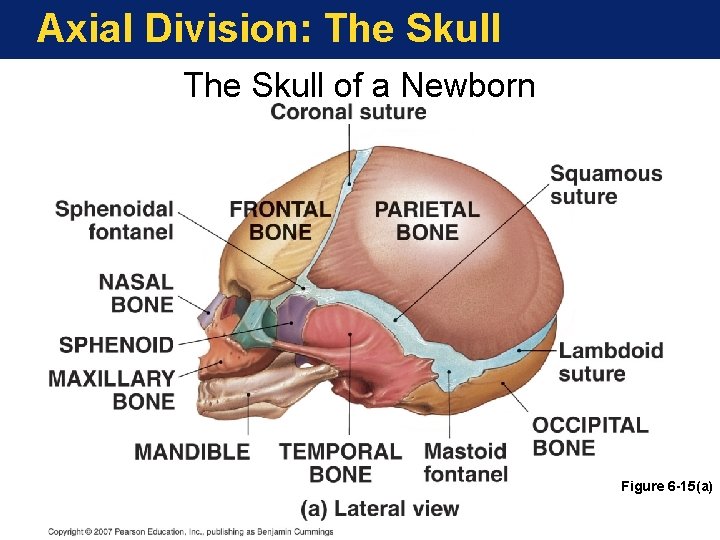 Axial Division: The Skull of a Newborn Figure 6 -15(a) 