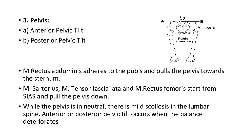 • 3. Pelvis: • a) Anterior Pelvic Tilt • b) Posterior Pelvic Tilt